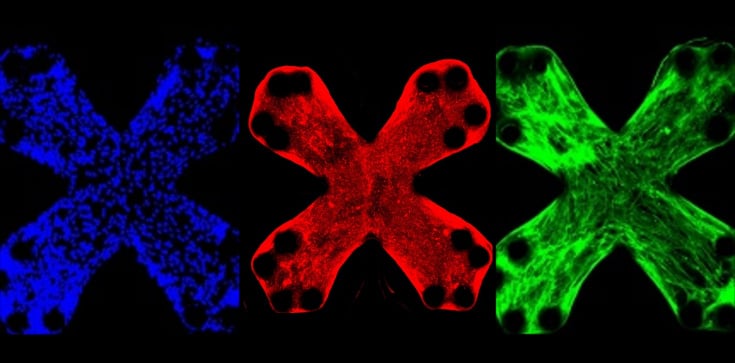 Featured Image by UB researchers develop technique for simulating fibrosis