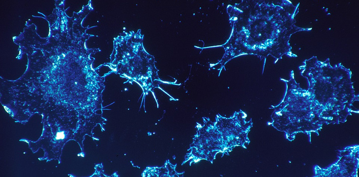 Featured Image by Scientists find link between chemotherapy and spread of cancer