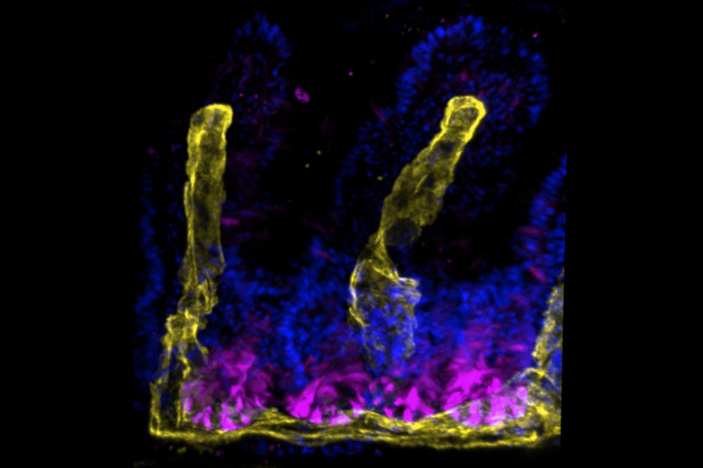 Featured Image by How the intestine replaces and repairs itself